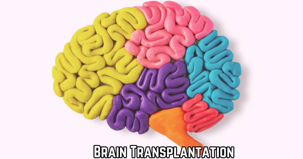 Brain Transplantation