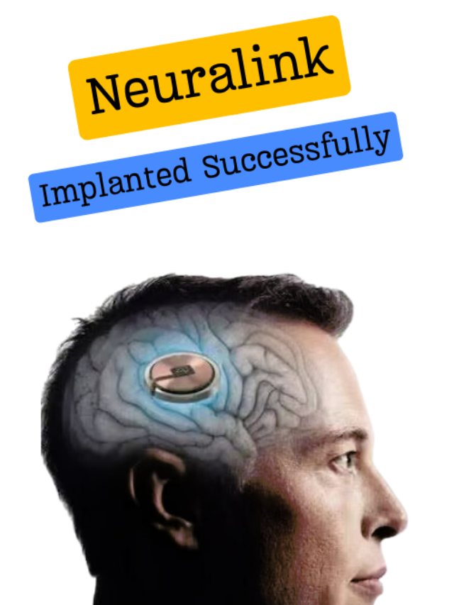 Breaking Boundaries: Elon Musk’s Neuralink Achieves First Brain Implant in Human Patient